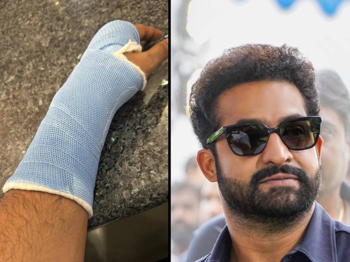 NTR with strained wrist